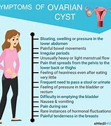 Image result for Ovarian Dermoid Cyst Symptoms