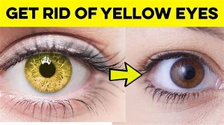 Image result for Yellow House Eye Doctor