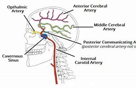 Image result for Carotid Artery to the Brain