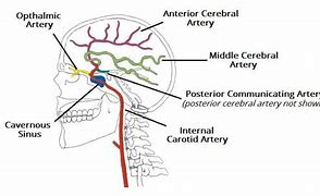 Image result for Arteries Anterior Middle Posterior Cerebral Basilar Internal Carotid Vertebral