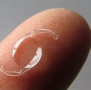 Image result for Spherical IOL Intraocular Lenses