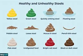 Image result for Stool Looks Grainy