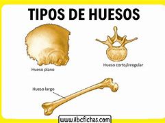 Image result for huesoso