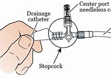 Image result for Biliary Drain Catheter