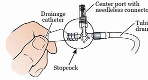 Image result for Biliary Drain Nursing