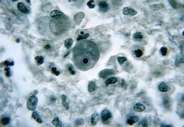 Image result for Chlamydia Microscopic