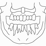 Image result for Kids Teeth X-ray