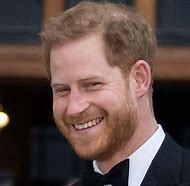 Image result for Prince Harry Rosacea