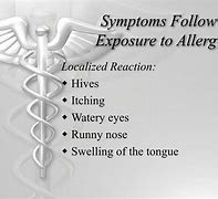 Image result for Allergic Reaction Hives