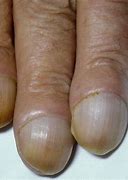 Image result for Two Nails On One Finger