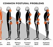 Image result for Bad Posture Back Pain