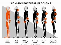 Image result for Examples of Bad Posture