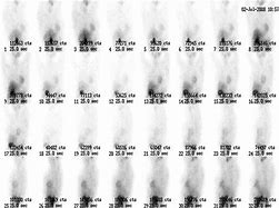 Image result for SPECT Cover