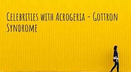 Image result for acrogeria