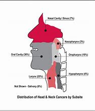 Image result for Unresectable Head and Neck Cancer