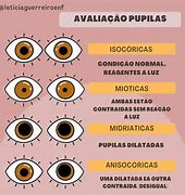 Image result for Tipos De Pupilas