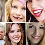 Image result for Person Smiling