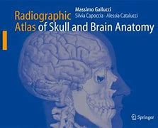 Image result for Brain and Skull Anatomy of a Ram