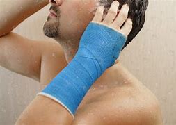 Image result for Waterproof Arm Cast