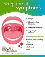 Image result for Bad Sore Throat