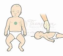 Image result for Infant CPR Clip Art