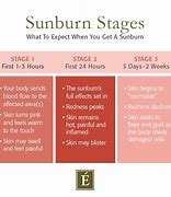 Image result for SunBurn Stages