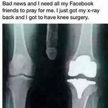 Image result for Funny X-ray of Brain in Knee