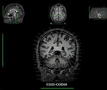 Image result for CC200 Brain Atlas