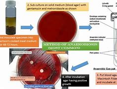 Image result for adrobiosis