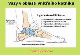Image result for abrupci�m