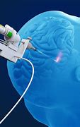 Image result for Neurosurgery Robot