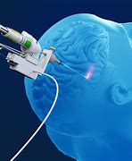 Image result for Med Laser Robot