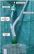 Image result for Uresil Tru-Close Suction Drainage System