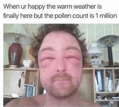 Image result for baby faces allergy meme