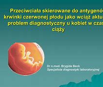 Image result for choroba_hemolityczna
