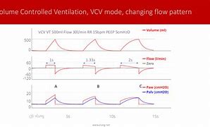 Image result for Ventilator PCV Mode
