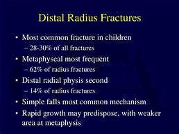 Image result for Galeazzi Fracture