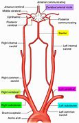 Image result for Carotid vs Vertebral Artery