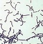 Image result for X100 Stain