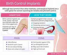 Image result for The Rod Birth Control Pros and Cons