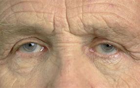 Image result for Old People Eyes