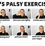 Image result for Bell's Palsy Face Exercises