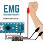 Image result for EMG Signal Wallpaper