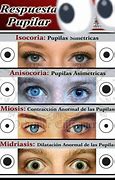 Image result for Pupilas Diferentes