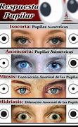 Image result for Tipos De Pupilas