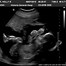Image result for 21 Weeks Pregnant Ultrasound
