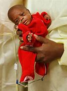 Image result for Tiniest Baby
