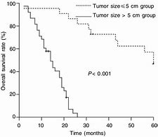 Image result for Tumor Size Measurement