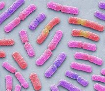 Image result for Bacillus Megaterium Gram Stain
