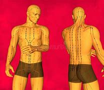 Image result for What Is Acupuncture
